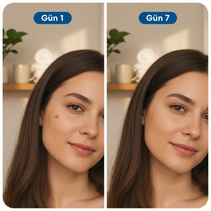 Cilt Temizleyici - 7 Günde İstenmeyen Lekelere Veda!
