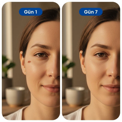 Cilt Temizleyici - 7 Günde İstenmeyen Lekelere Veda!