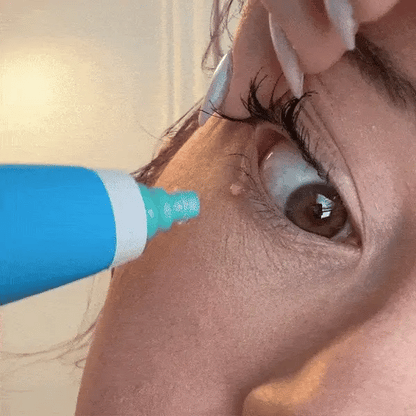 Cilt Temizleyici - 7 Günde İstenmeyen Lekelere Veda!